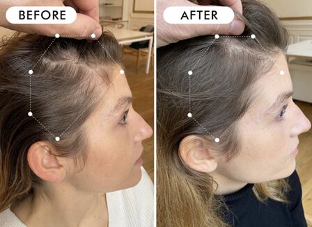 Hair Regrowth Serum for Women